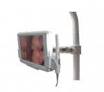 M-968 intraoral camera M-968 intraoral camera