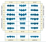 Quattro Intro-Set bridge links, Quattro Intro-Set bridge links,